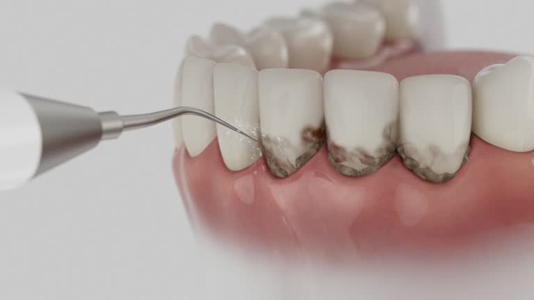 Reliable Dental contractor in Bothell West, WA by Dentist Open Now